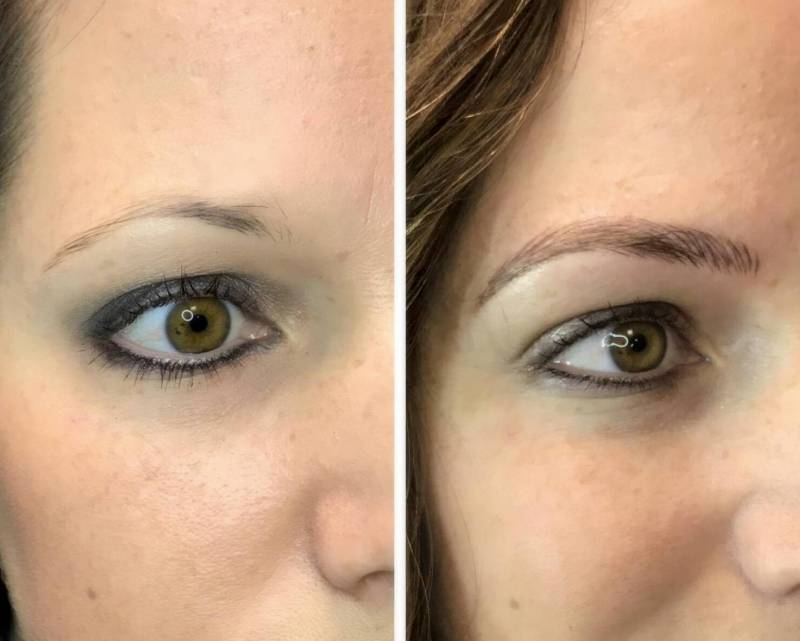 My Microblading Experience